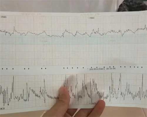 x染色体和y染色体区别，做试管时哪个更重要~代妈公司哪个靠谱